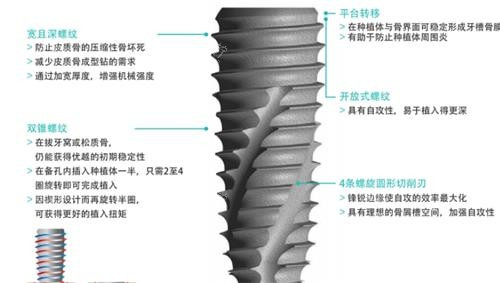 柯威尔植体是什么档次?和奥齿泰比怎么样